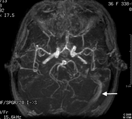 Fig 2.