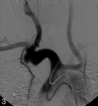 Fig 3.
