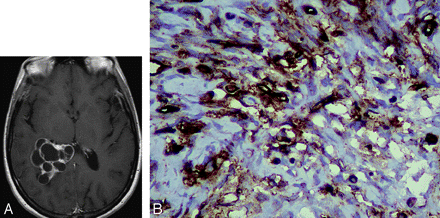   Fig 1. 