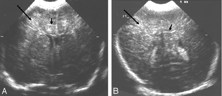 Fig 5.
