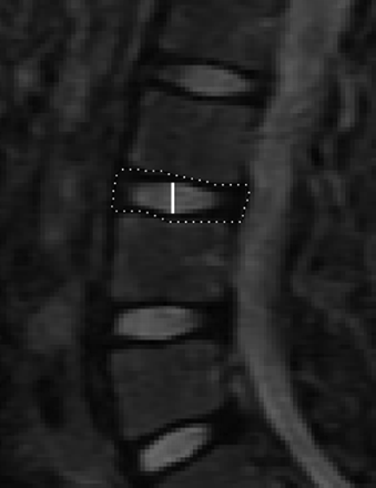 Fig 2.