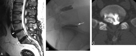 Fig 2.