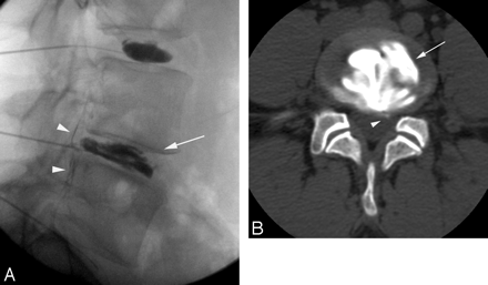 Fig 4.