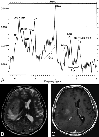 Fig 2.