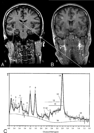 Fig 1.