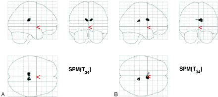 Fig 3.