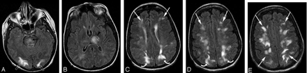 Fig 2.