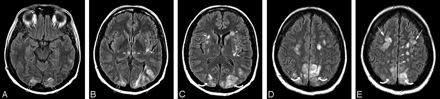 Fig 4.