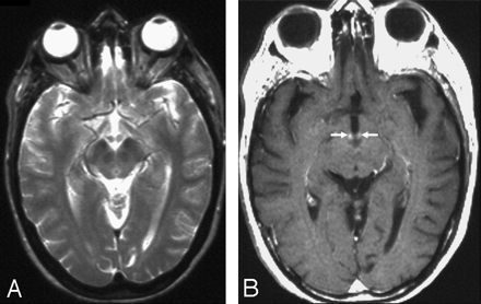 Fig 4.