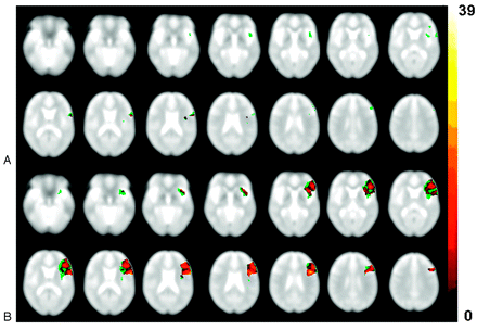 Fig 3.