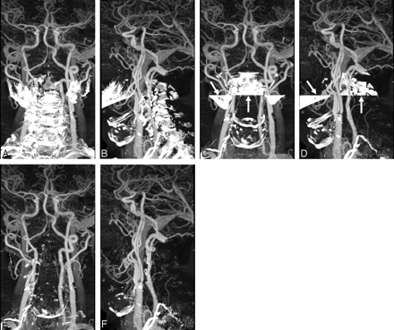 Fig 1.