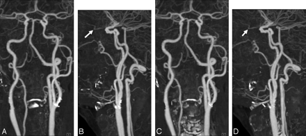 Fig 2.