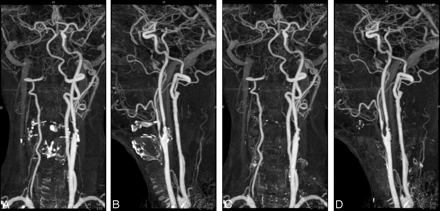 Fig 3.