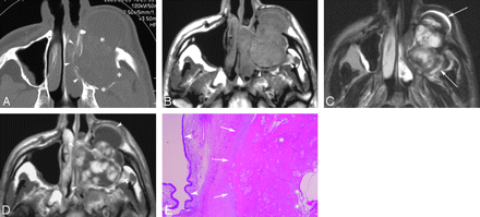 Fig 1.