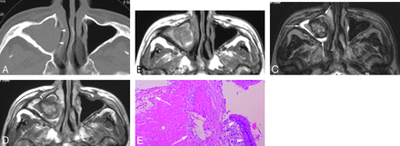 Fig 2.