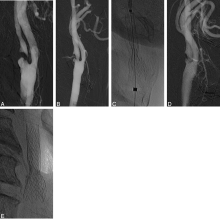 Fig 2.