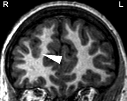 Fig 4.