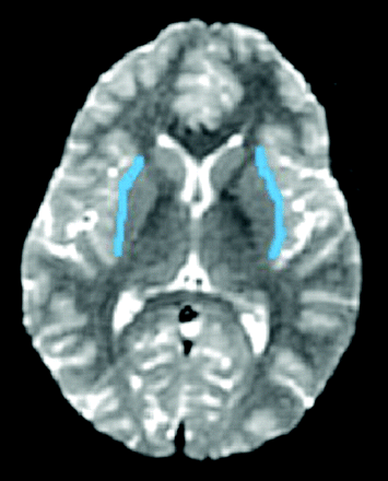 Fig 1.