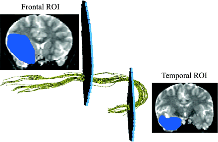 Fig 2.