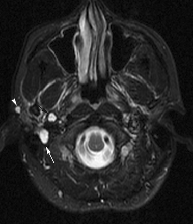 Fig 6.