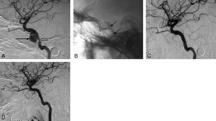 Fig 3.