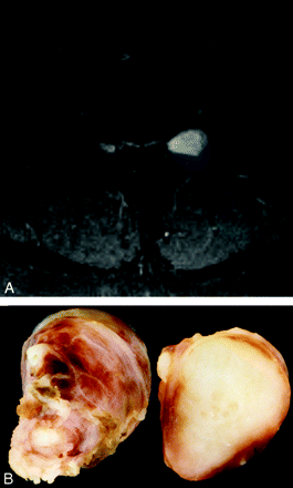 Fig 5.