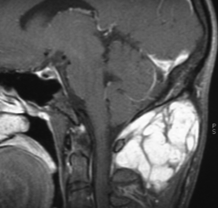 Fig 6.
