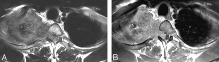 Fig 1.
