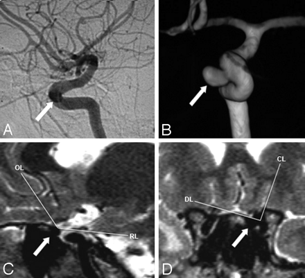 Fig 3.
