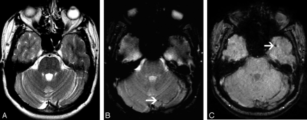 Fig 2.