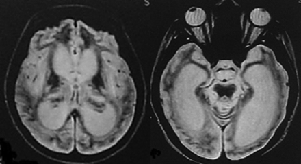 Fig 5.