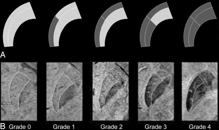 Fig 2.