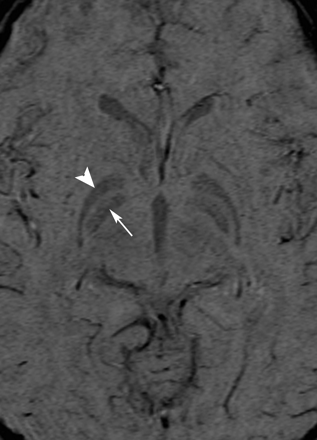 Fig 3.