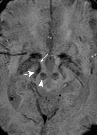 Fig 5.