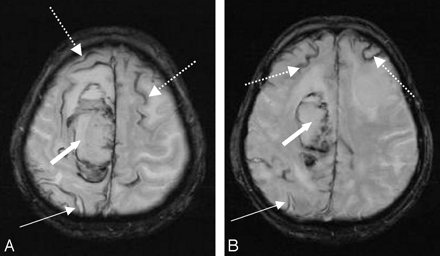 Fig 3.