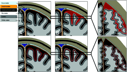 Fig 4.