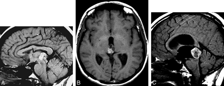 Fig 2.