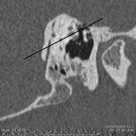 Fig 6.