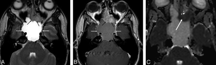 Fig 2.