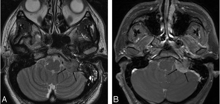Fig 5.