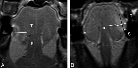 Fig 3.