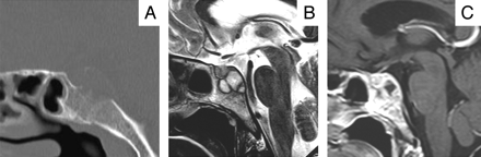 Fig 1.