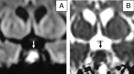 Fig 2.