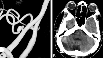 Fig 3.