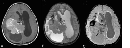 Fig 12.