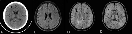 Fig 3.
