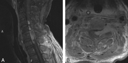 Fig 3.