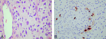 Fig 4.
