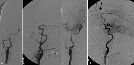 Fig 2.