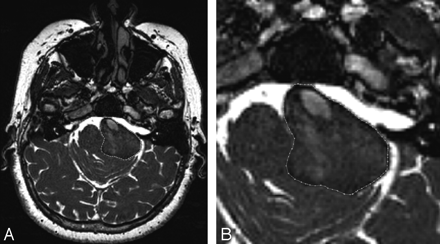 Fig 2.